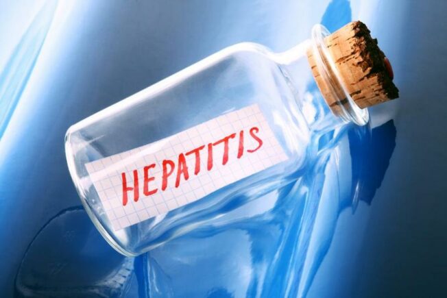 Symptoms and Diagnosis of Hepatitis C