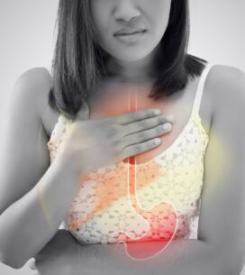 Complete Guide on Acid Reflux﻿ and treatment
