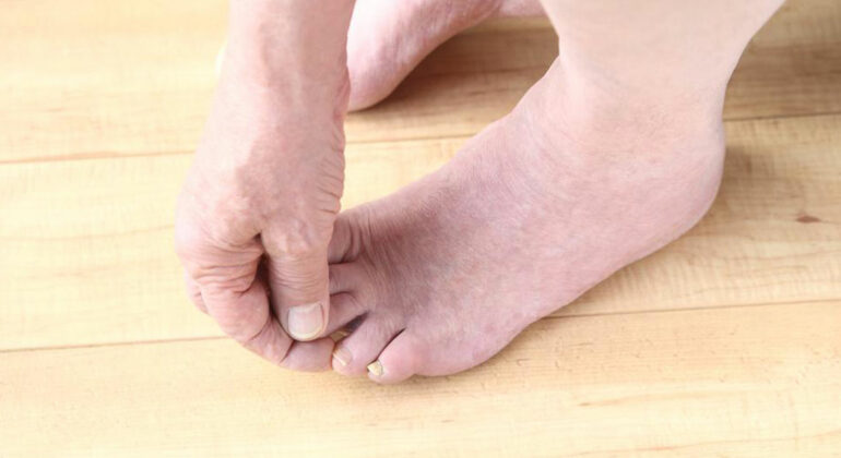 Taking a look at causes of foot pain
