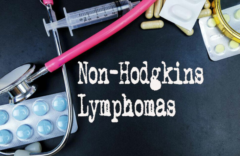 6 common risk factors for Non-Hodgkin lymphoma