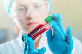 Here’s why maintaining normal creatinine levels is imperative