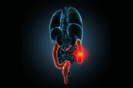 Signs and symptoms of colitis