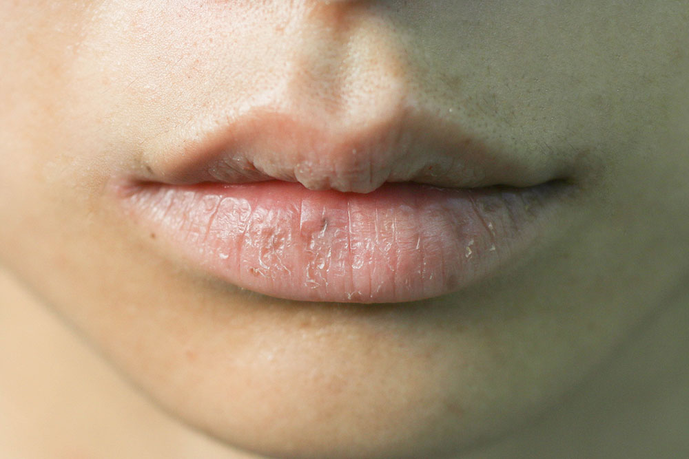 4 common mistakes that make one’s lips dry and damaged