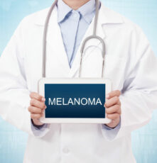 3 effective tips for dealing with melanoma