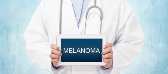 3 effective tips for dealing with melanoma