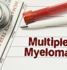 7 Warning Signs and Symptoms of Multiple Myeloma