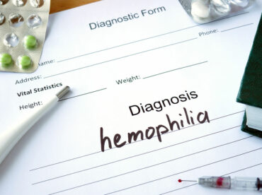 8 signs and symptoms of hemophilia