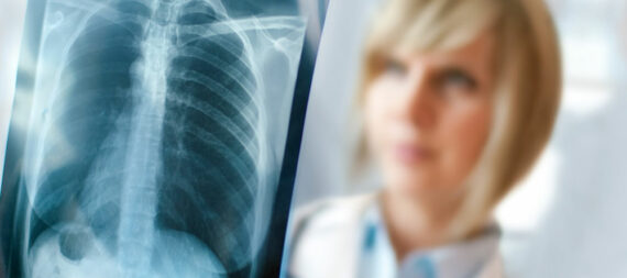 Signs and symptoms that may indicate lung diseases