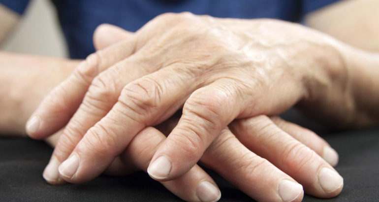3 natural remedies for fibromyalgia arthritis