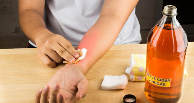 4 common treatments for itchy skin