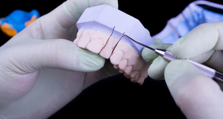 7 useful tips to reduce your denture costs
