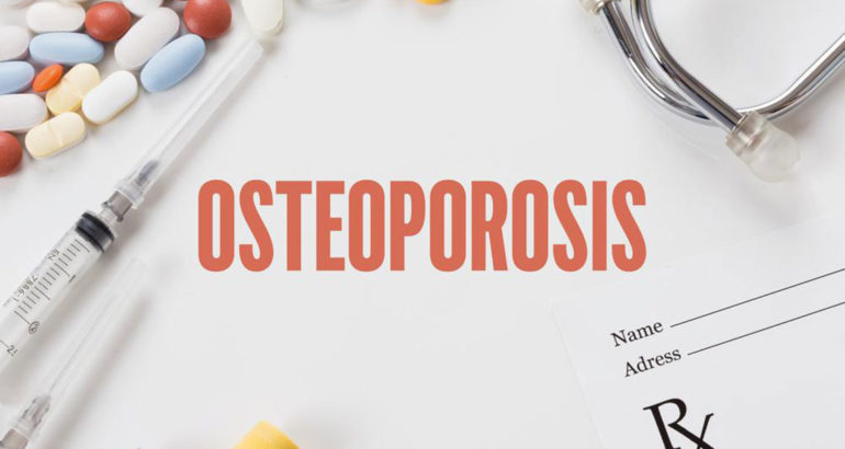 Bone density testing – An important diagnostic tool for osteoporosis