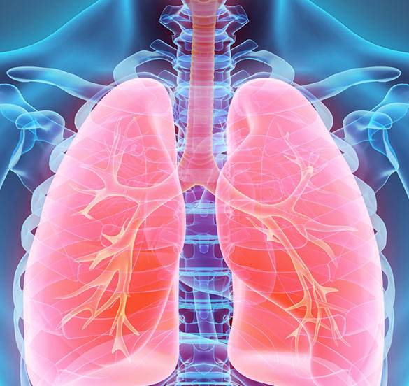 Everything you should know about lung cancer