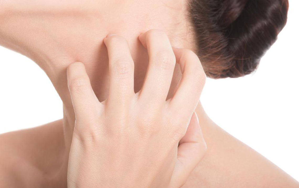 6 common types of eczema disorders you should know about