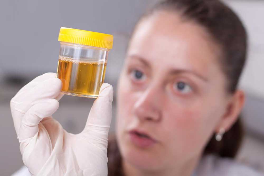 Determining Your Health with a Urine Color Chart
