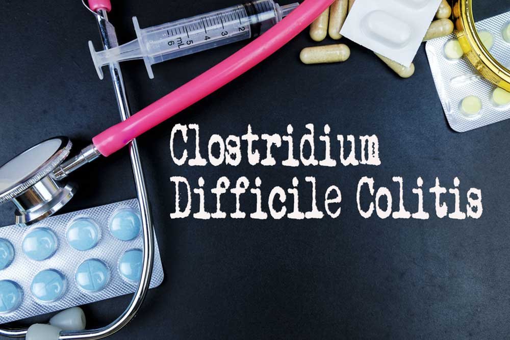 Early Symptoms of Clostridium Difficile Colitis