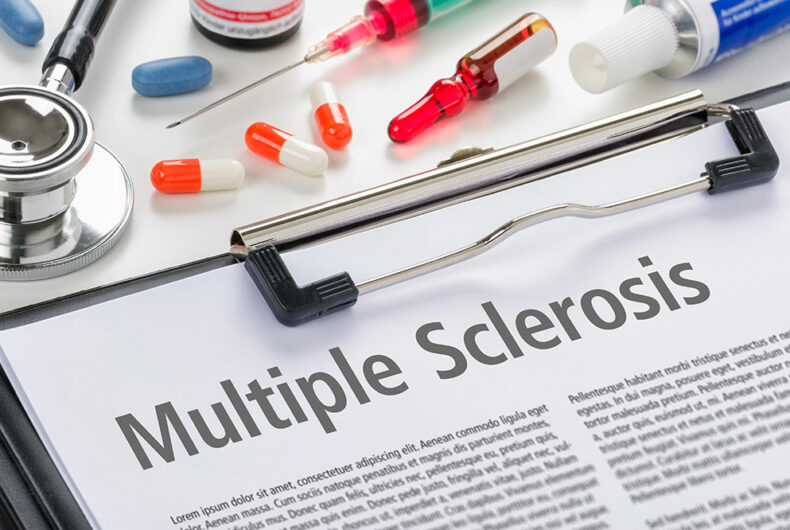 Stages, diagnosis, and prevention of multiple sclerosis