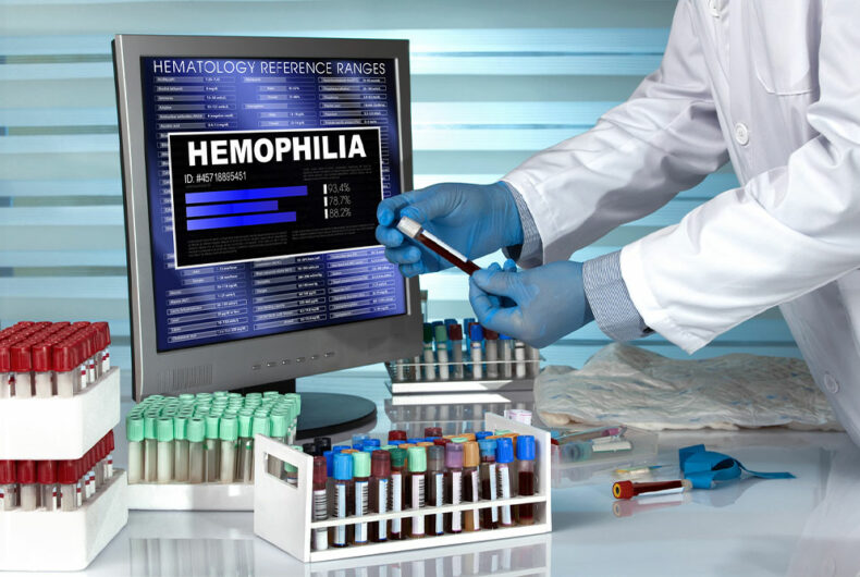 5 ways to live healthy with hemophilia