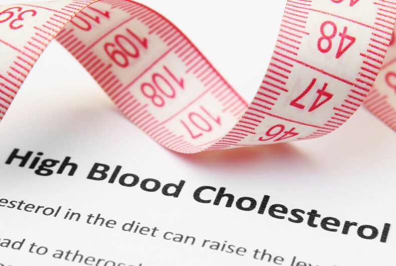 Symptoms, causes, and risks of high cholesterol